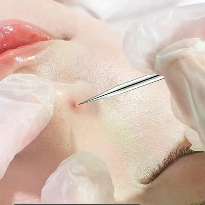 3 - 8Pcs Blackhead Clip Pimples Tweezer Blackhead Remover Stainless Steel Cell Clip Beauty Product Acne Needle Skin Cleanning Tool - US Stores