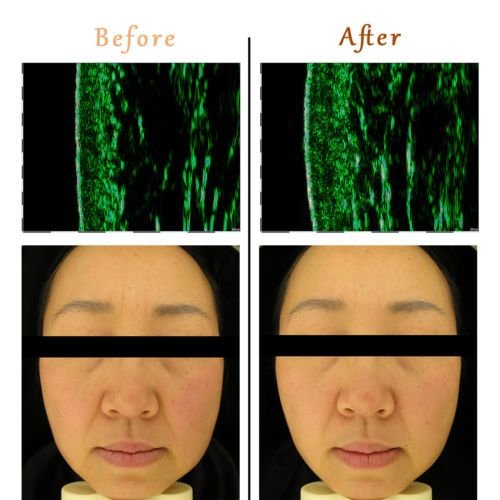 (new) Made in KOREA led face mask light therapy led mask red light IR photon skin rejuvenation - US Stores