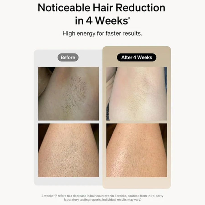 Professional Laser Epilator IPL Hair Removal Body Bikini Leg Depilatory Devic 900,000 Flashes 5 Levels Epilator Painless Electric Epilator Machine - US Stores