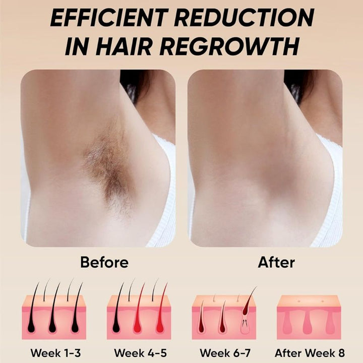 Professional Laser Epilator IPL Hair Removal Body Bikini Leg Depilatory Devic 900,000 Flashes 5 Levels Epilator Painless Electric Epilator Machine - US Stores