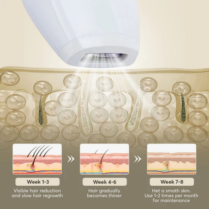 Professional Laser Epilator IPL Hair Removal Body Bikini Leg Depilatory Devic 900,000 Flashes 5 Levels Epilator Painless Electric Epilator Machine - US Stores