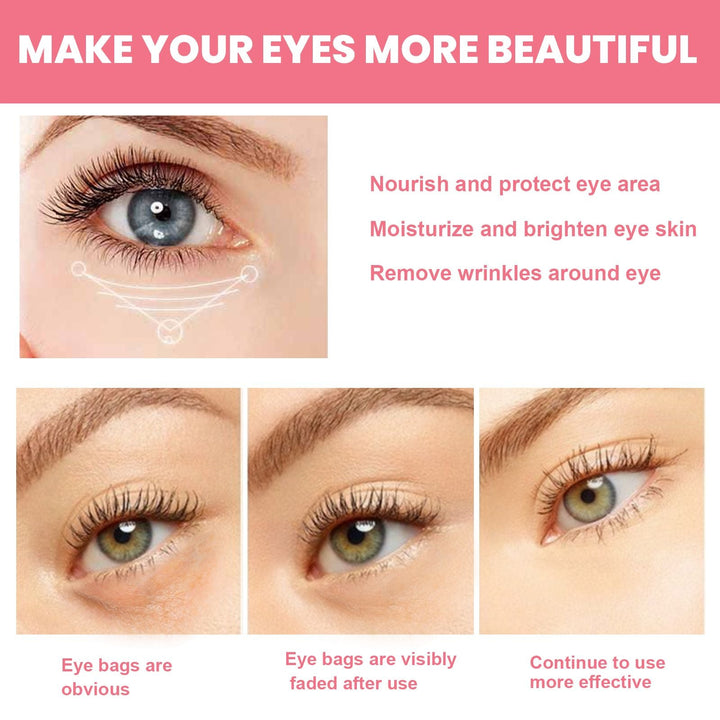West&Month Rosehip Eye Cream Stick, Eye Area Moisturizing Light Line Dark Circles Lift Firming Eye Cream - US Stores